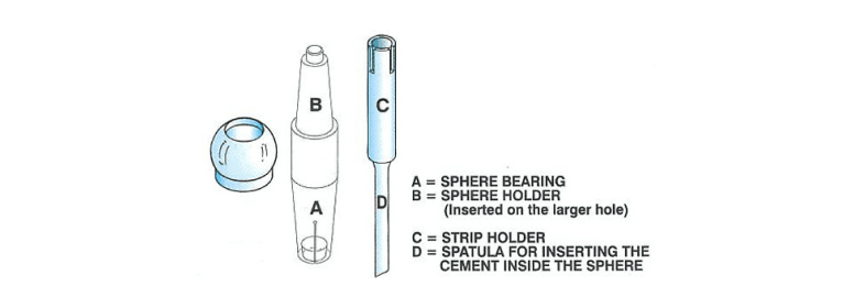 Concave Sphere Reconstruction Kit