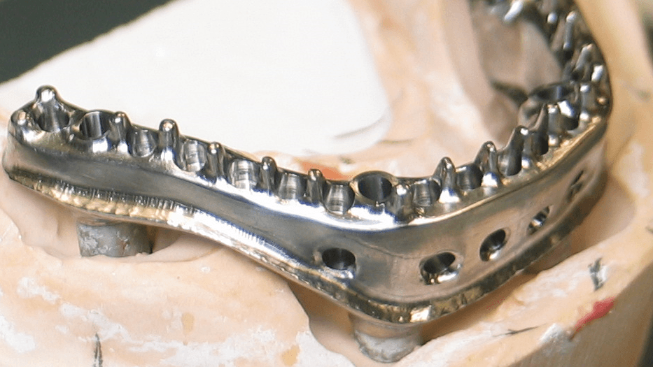 Mechanical retention!