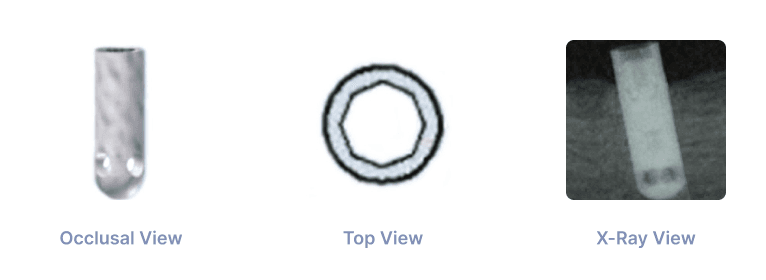 CALCITEK OMNILOC 4.0mm DIAMETER