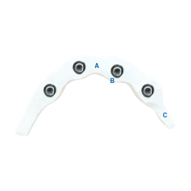 TriLor Indications for Design