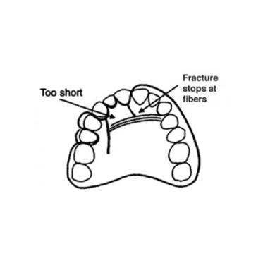 Fiber Technology Proper Placement