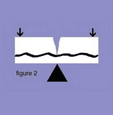 Fiber Technology Stress Fracture Figure 2