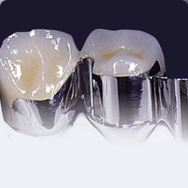 Preci Vertix Attachment System