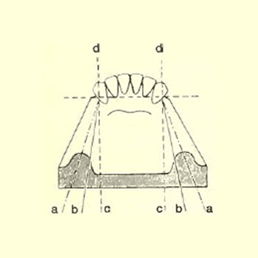American Mini Attachment