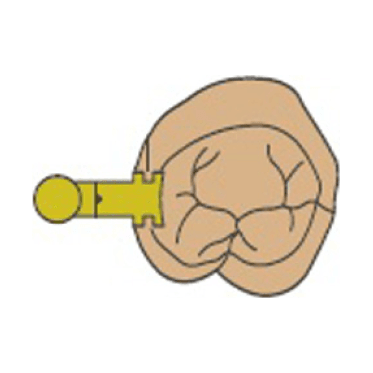 American Mini Attachment