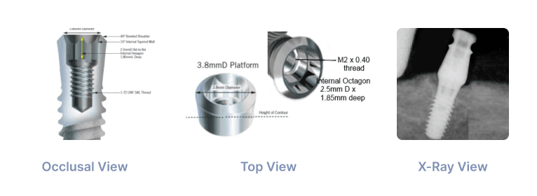 Paragon Swiss Plus 3.8mm