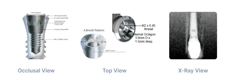 Paragon Swiss Plus 4.8mm