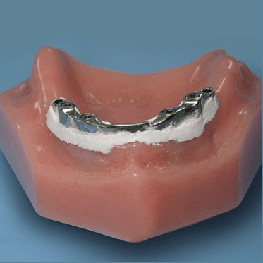 Perma Block - Block Out Material