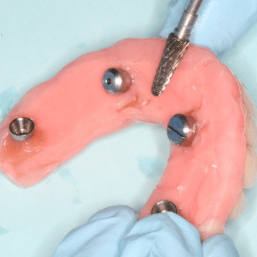 Bidra Conversion Smart Polishing Caps