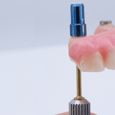 Bidra Conversion Smart Polishing Caps