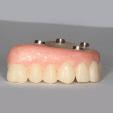 Bidra Conversion Smart Polishing Caps