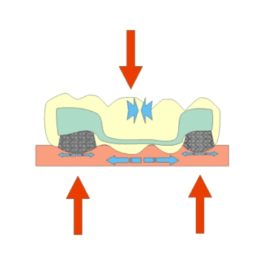Fiber Technology Position and Placement