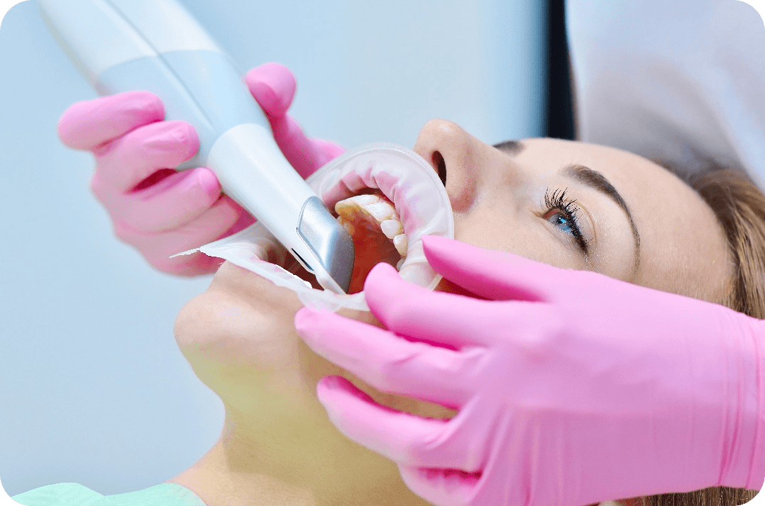 Preat_AbutmentItraoralScanStock