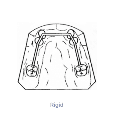 Preci Bar Dolger System Rigid