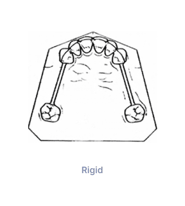 Preci Bar Dolger System Rigid