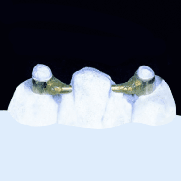 Round Bar Attachment