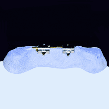 Round Bar Attachment