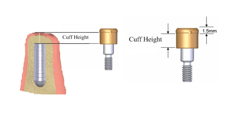 8000080 - Cuff Height Measuring Tool