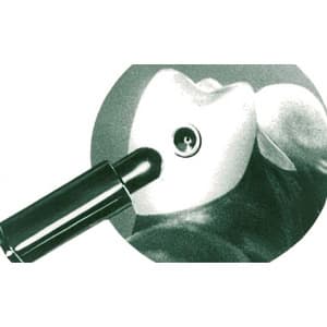 Universal-IC-Attachment-2