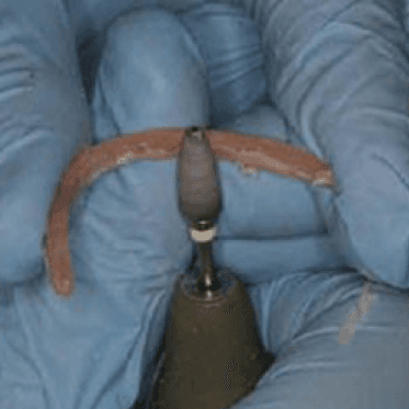 Fiber Technology Proper Placement