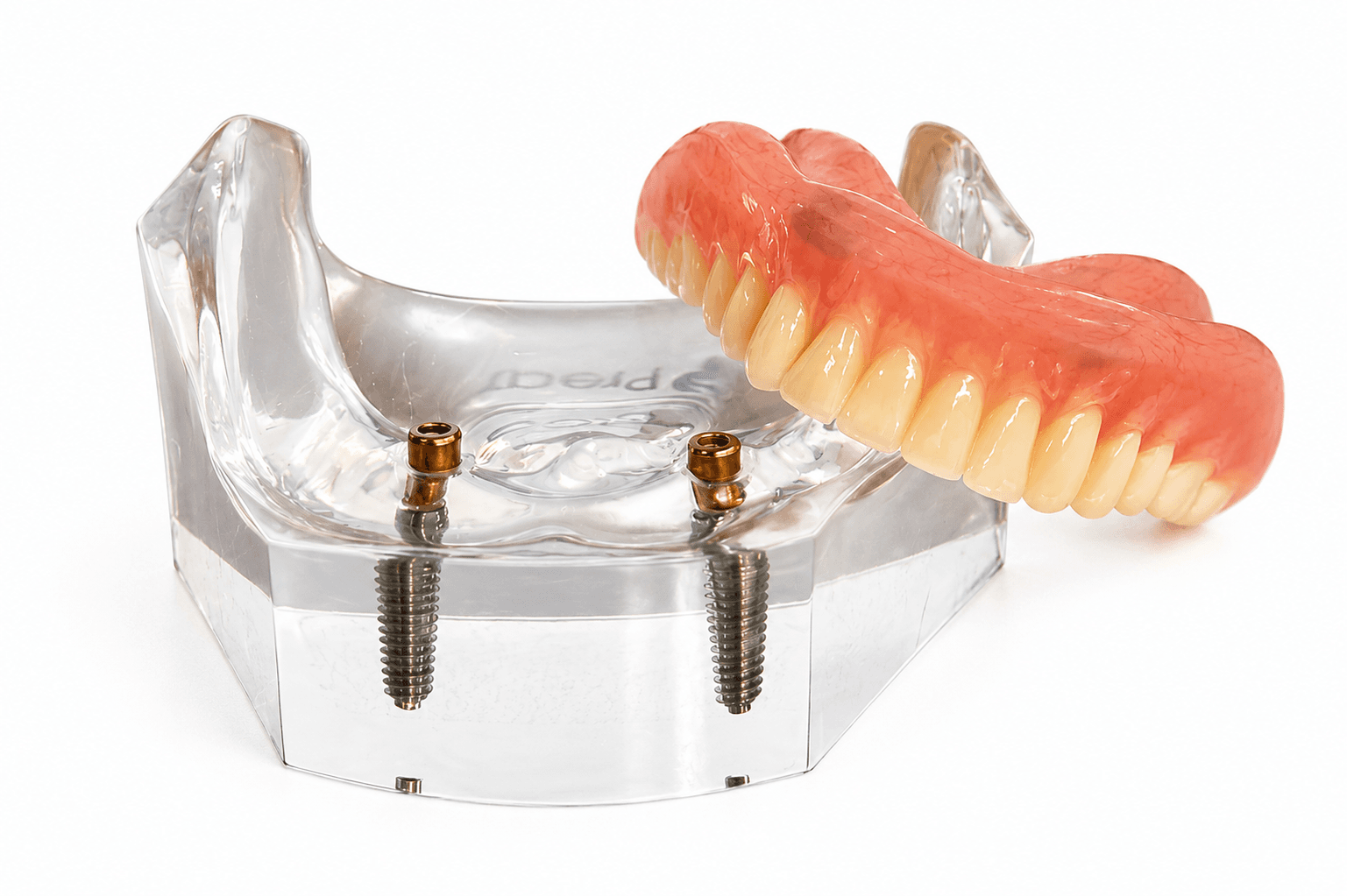 PreatLoc™ 2 Implant Patient Education Model