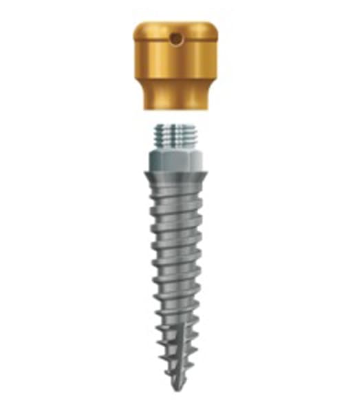 LODI Implant 2.4mm X 10mm, 2.5mm Cuff