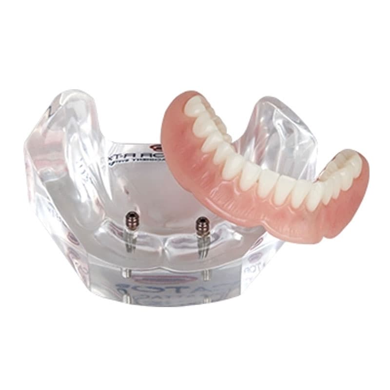 LOCATOR® R-Tx Education Patient Model - No Divergence