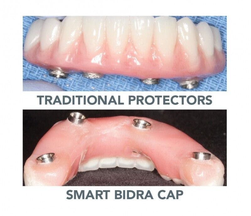 Bidra® Conversion Smart Polishing Cap (4-pack)